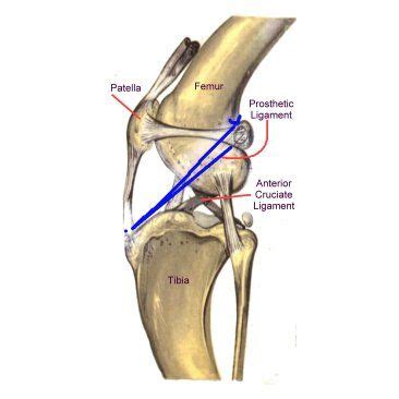 Cruciate Ligament In Dogs Results For Yahoo Image Search Results Cruciate Ligament In Dogs Results For Yahoo Image Search Results