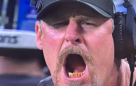 Dan Campbell Teeth: What His Smile Tells Us About His Leadership Style