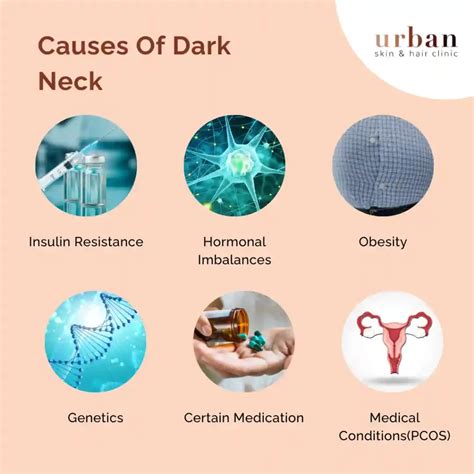 Dark Neck Causes Symptoms Treatment