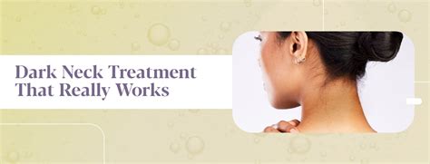 Dark Neck Causes Treatments Prevention Tips Innovist