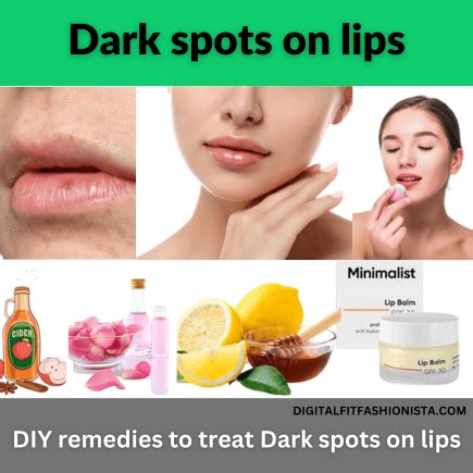Dark Spots On Lips Revealing Causes Treatments And Diy Remedies
