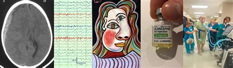 Delirium Emcrit Project Delirium Emcrit Project