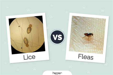 Difference Between Lice And Fleas Difference Between Lice And Fleas