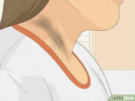 Dirt Neck Causes, Treatments, and Prevention Tips