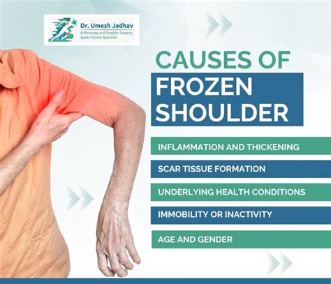 Discovering The Best For Pain Relief What Is The Most Effective Treatment For Frozen Shoulder Sunnyvale Sports Medicine And Orthopedic Center