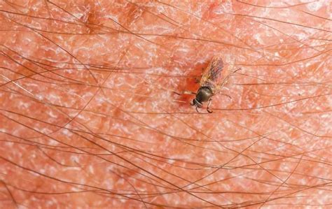 Do Gnats Bite Humans Anzish Home