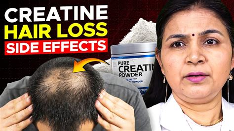 Does Creatine Cause Hair Loss Youtube