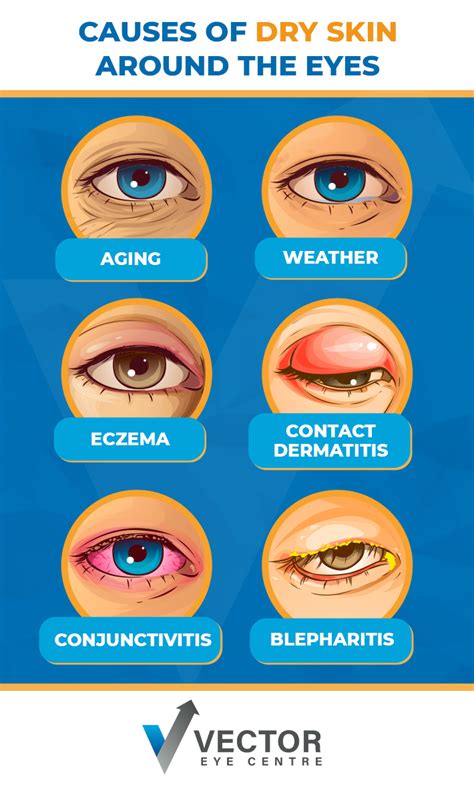 Dry Skin Around Eyes Or Eyelids Causes And Treatments Skincarederm