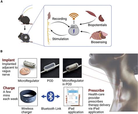 Effect Of Defibrillation On The Performance Of An Implantable Vagus Nerve Stimulation System Bioelectronic Medicine Springer Nature Link