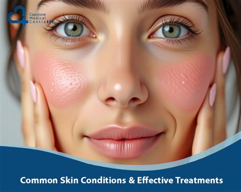 Effective Online Treatments For Common Skin Conditions