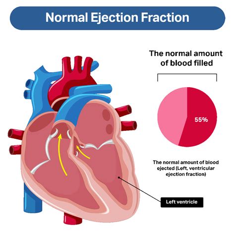 Understanding Normal Ejection Fraction Ranges: What You Need to Know