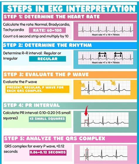 Ekg Interpretation Steps Vrogue Co