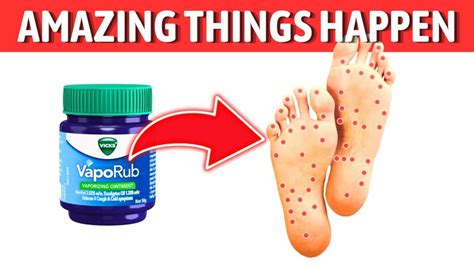 Experience The Magic Of Applying Vicks Vaporub On Your Feet Healthy