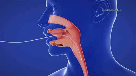 Fda Cancer Screening Brings Lifesaving Test To Firefighters Wwltv Com