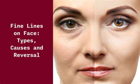 Fine Lines On Face Types Causes And Reversal Ningen Skin Sciences Pvt Ltd