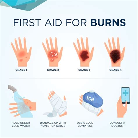First Aid Tips How To Help A Person With Burn Injuries Health News