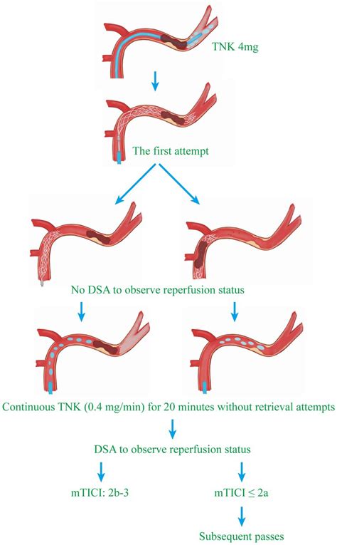 Frontiers Intra Arterial Tenecteplase Is Safe And May Improve The