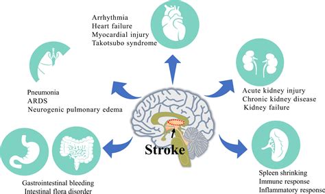 Frontiers Peripheral Organ Injury After Stroke Frontiers Peripheral Organ Injury After Stroke