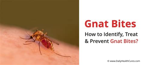 Gnat Bite Symptoms Self Care And Prevention