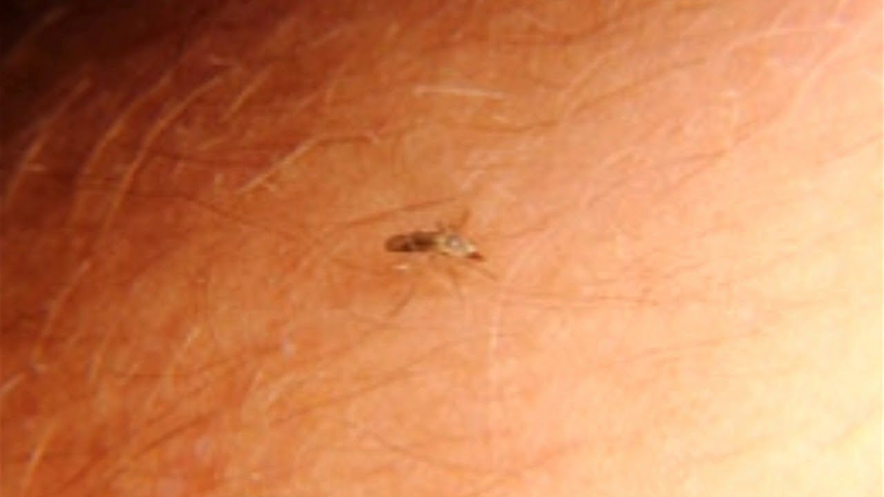 Gnat Bites Symptoms And Causes Gnat Bites Symptoms And Causes
