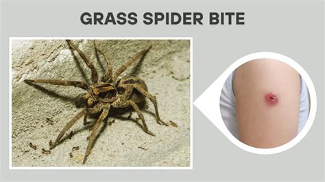 5 Tips Grass Spider Bite