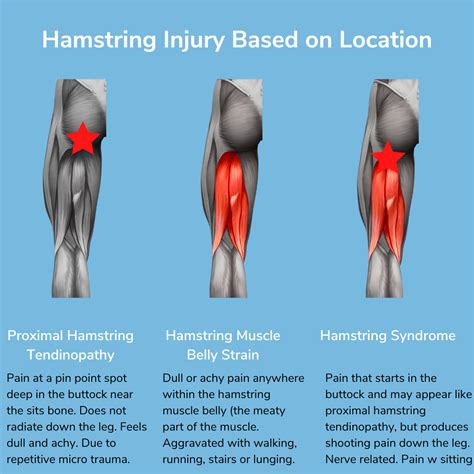 Hamstring Pain Behind Knee When Bending At Otto Walters Blog