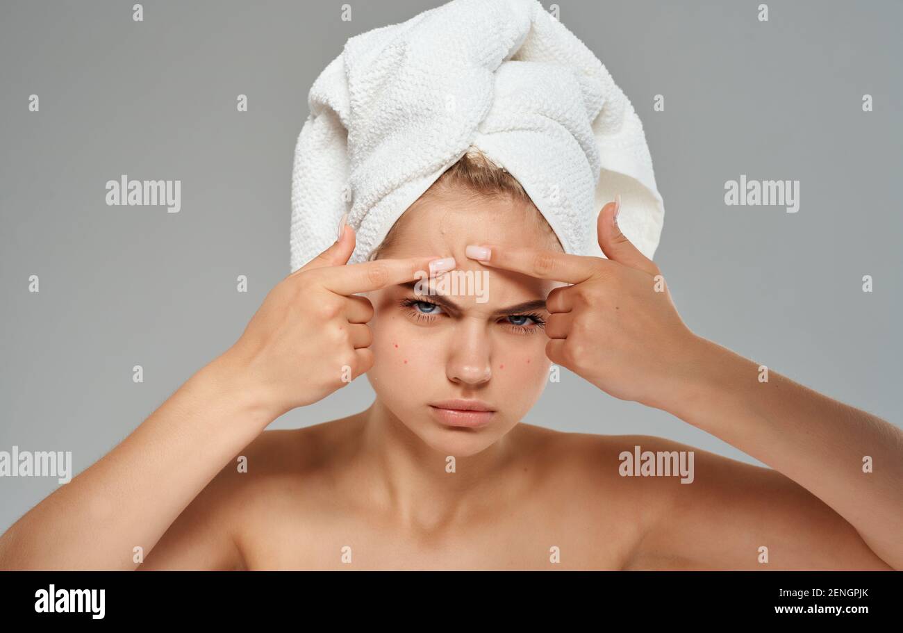 Head And Shoulders Pimples