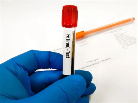 Health Partners Iron Blood Test