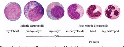 High Immature Granulocytes