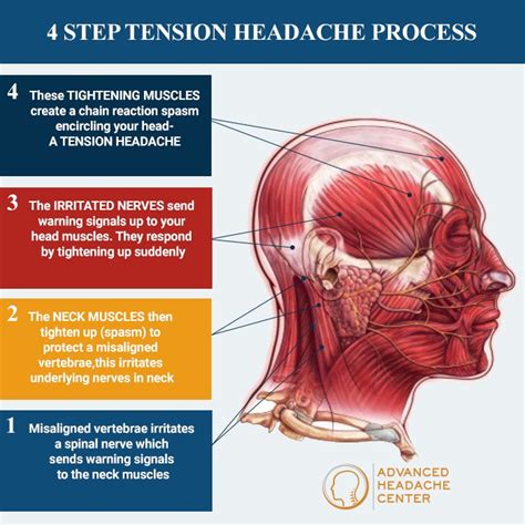 How Do You Release Tension Headaches Health Blog