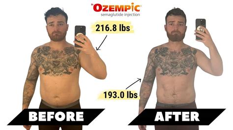 Ozempic Weight Loss Effects