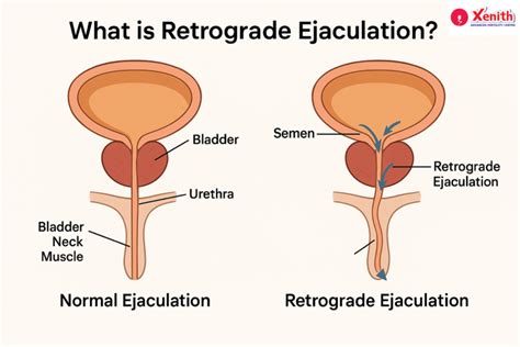 How Flomax Can Help With Retrograde Ejaculation Allo Health