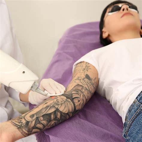How Much Is Tattoo Removal Everything You Wanted To Know About Tattoo