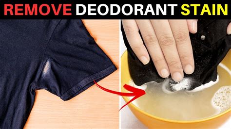 How To Get Deodorant Stains Out Of Shirts