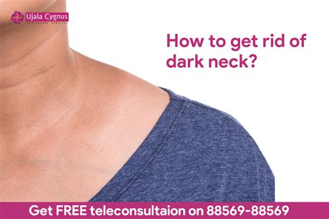 How To Get Rid Of Dark Neck Ujala Cygnus