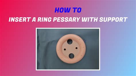 Inserting a Pessary Made Easy