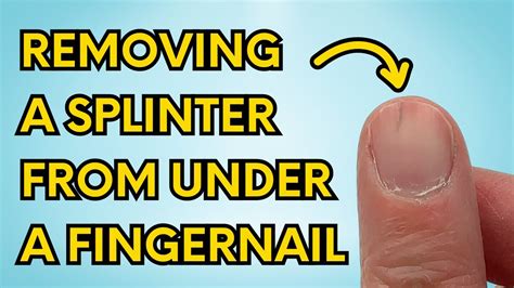 How To Remove A Splinter Under Your Fingernail 10 Steps Splinter