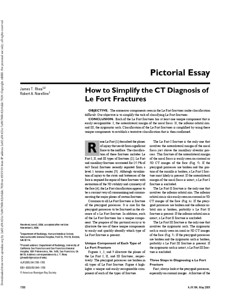How To Simplify The Ct Diagnosis Of Le Fort Fractures Ajr