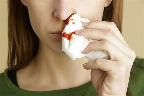 How To Treat Chronic Nose Bleeds Ear Nose And Throat Center