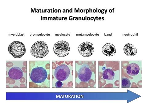 Immature Granulocytes Igs What They Are And What Ig Count Means