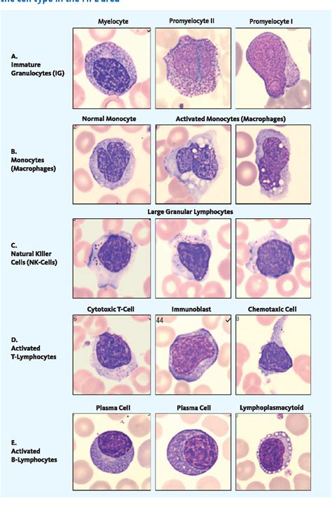 Immature Granulocytes Low