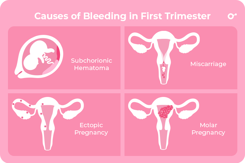 Implantation Bleeding Causes Symptoms Fertility2family Australia