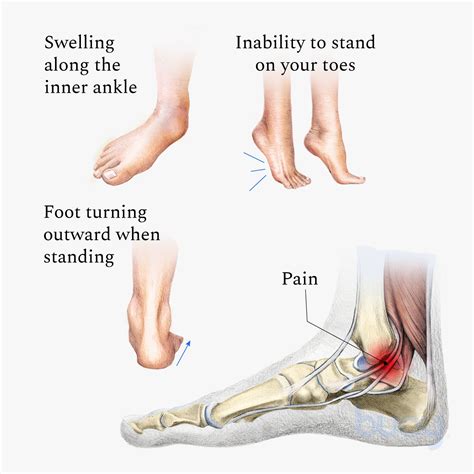Inner Ankle Pain