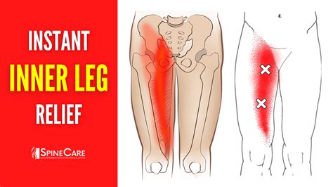 Inner Thigh Pain