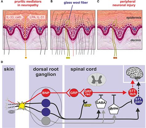 Itching Skin Sensation Nerve Fibers Pruritus Britannica