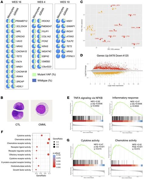 Jci Cxcl8 Secreted By Immature Granulocytes Inhibits Wt Hematopoiesis In Chronic Myelomonocytic Leukemia