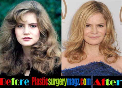 Jennifer Jason Leigh Plastic Surgery Clinic Mono
