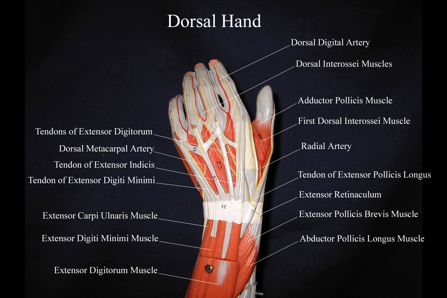 Joints Of The Right Hand Dorsal View Note That The Terms