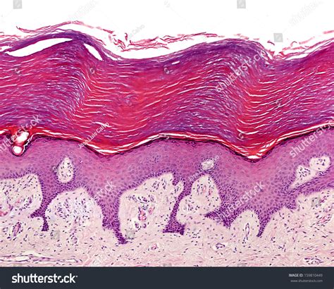 Keratinized Stratified Squamous Epithelium Thin Skin X400 Diagram