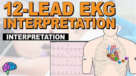 Leads Ecg Explained At Nina Pierson Blog